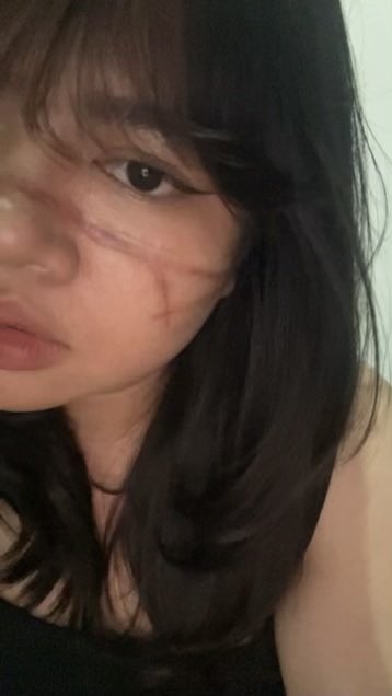 ronaprvy's tweet photo. I LOVE THIS SCARS!!
but need more bloods, maybe?? https://t.co/Rua7oTTQxX