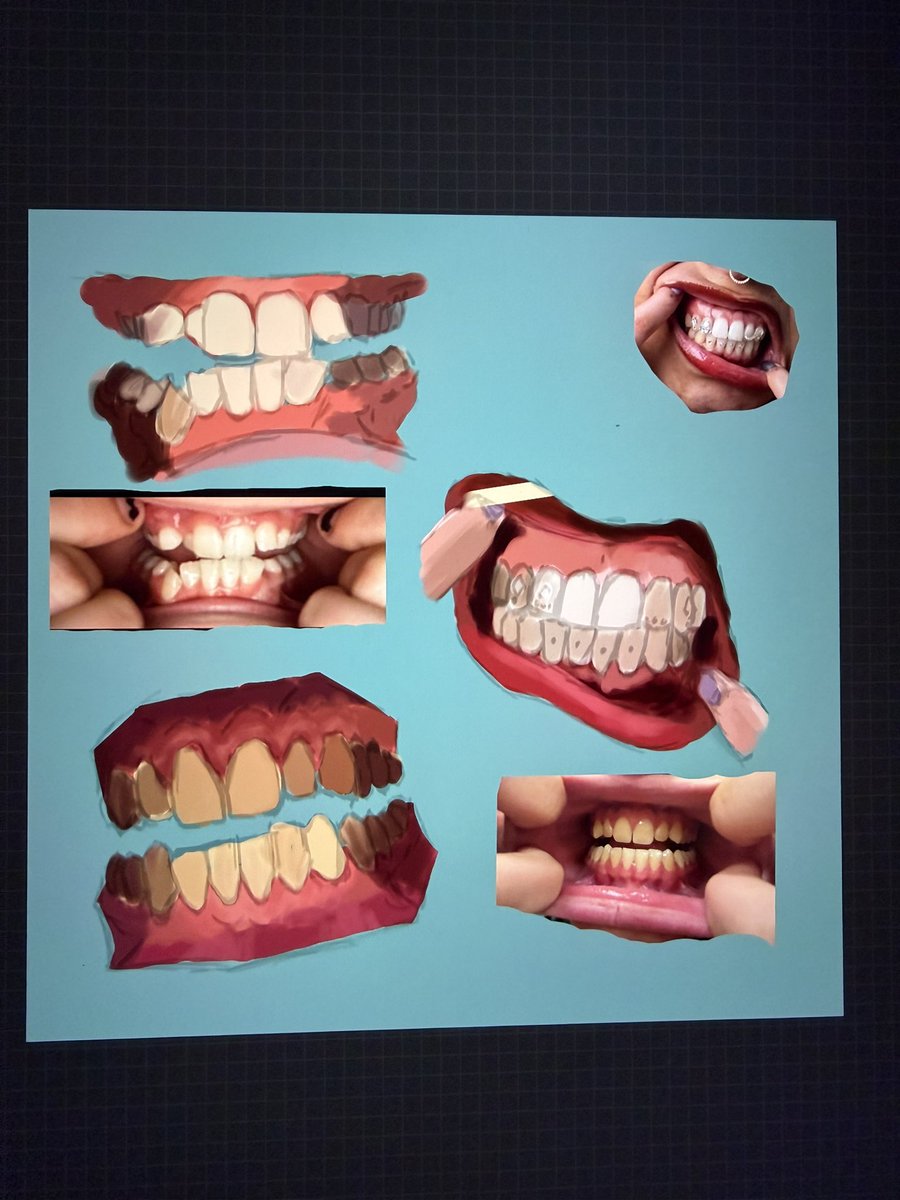 art_platypus's tweet image. OMG is this, teeth? Who could have guessed #wip #teeth #teethart #digitalart #procreate