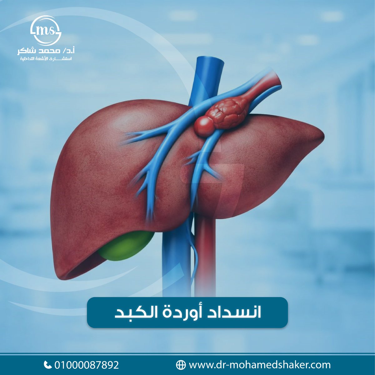 drMoShaker1's tweet photo. #انسداد_أوردة_الكبد قد يكون بسبب تجلط دموي، أمراض الدم، أو حالات التهابية. 
العلامات المبكرة قد تكون خفية، مثل.... 

يمكنكم قراءة المنشور الكامل بالضغط على الرابط التالي 
https://t.co/evFiybWpPz https://t.co/A60212bCyn