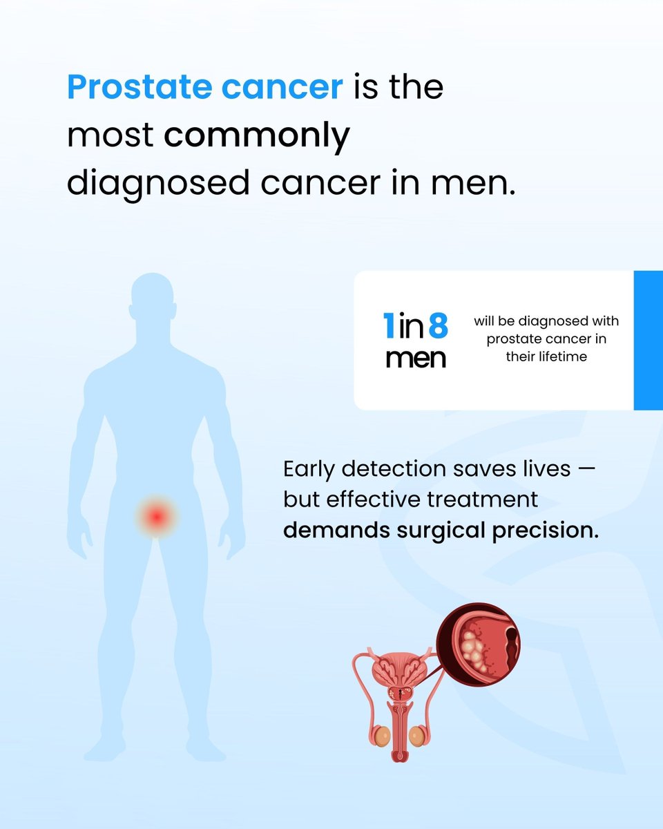 IMRASurgical's tweet photo. Robotic prostatectomy is now the standard of care for prostate cancer — but the learning curve is steep.

Research suggests surgeons need 150–250+ procedures to reach proficiency. And the steps that matter most — nerve-sparing dissection, urethral anastomosis — are the ones where experience has the greatest impact on patient quality of life.

The challenge for training programs isn't access to the robot. It's creating enough quality repetitions before surgeons are unsupervised.

That's what realistic simulation is for.

Swipe through to see why surgical training in robotic prostatectomy matters — and what good preparation actually looks like. 

#UrologySurgery #RoboticSurgery #SurgicalTraining #Prostatectomy #MedicalEducation #Urology
