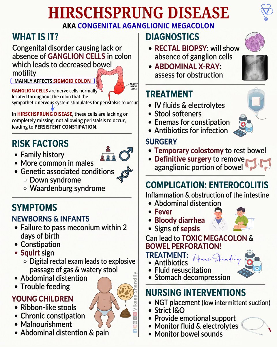 VikaasShandily's tweet image. Hirschsprung Disease: Causes, Symptoms, Diagnosis &amp;amp; Treatment (Pediatric)
#HirschsprungDisease #Pediatrics #VikaasShandily #CongenitalDisorders #NursingStudy
