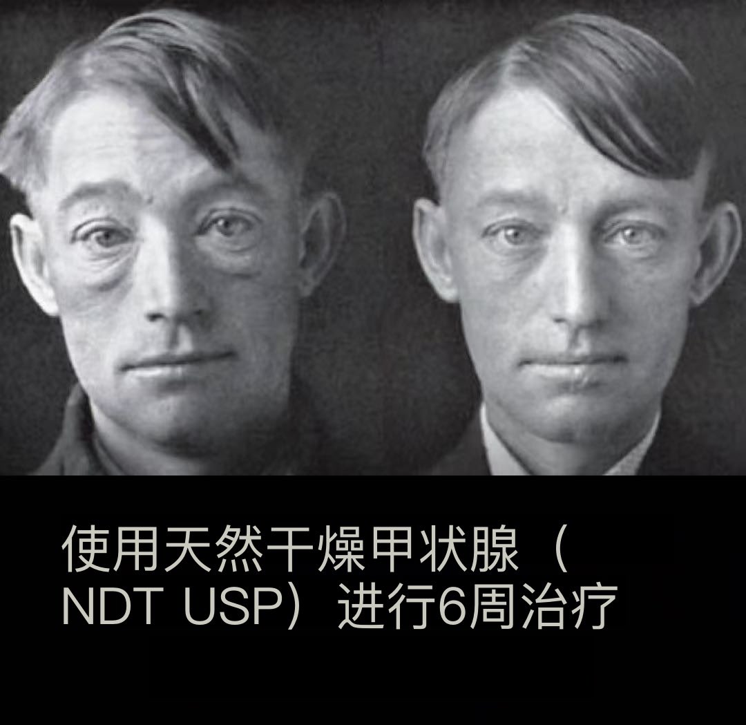 宇峒 tweet media