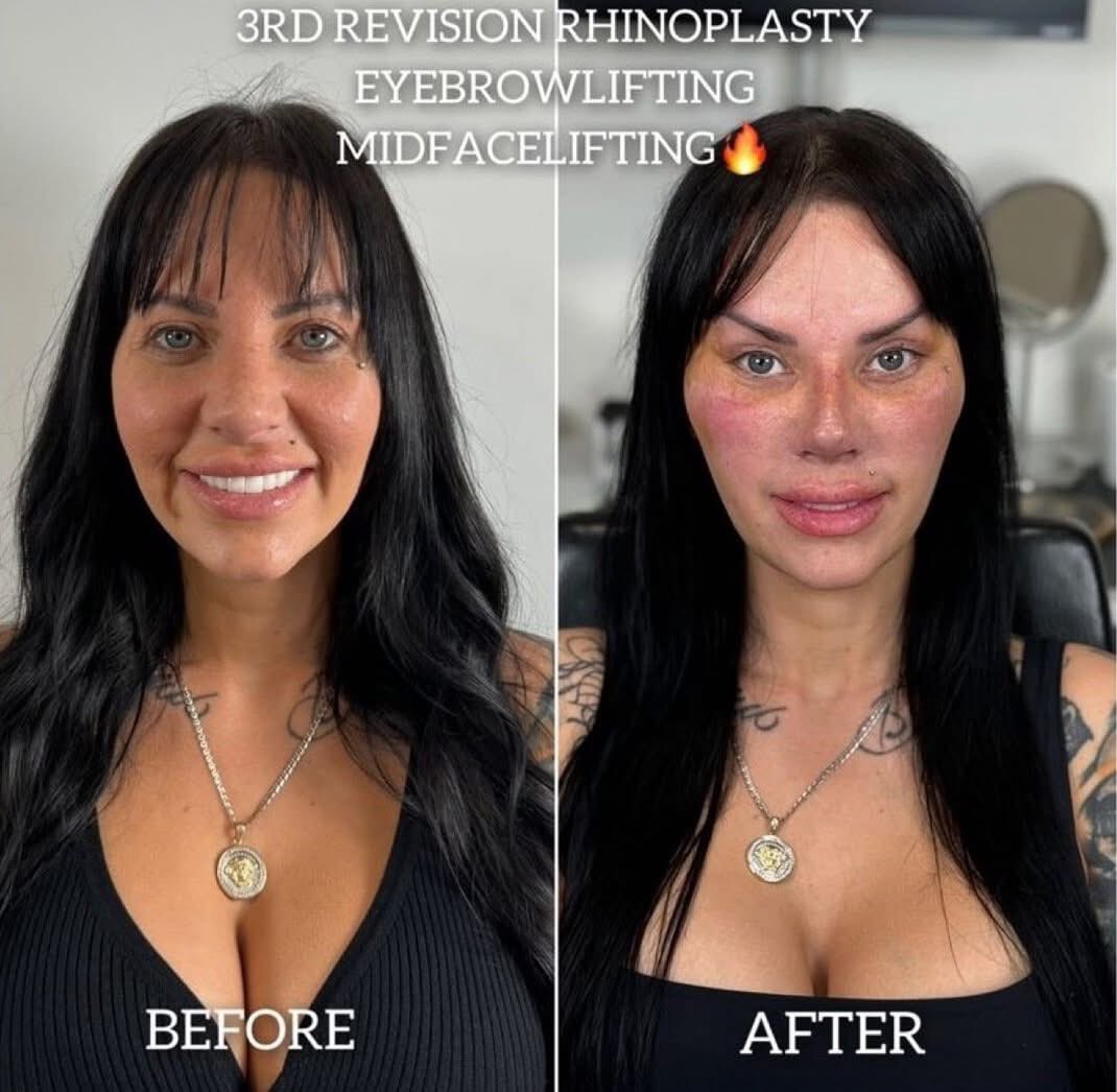 ItsGundo! tweet media