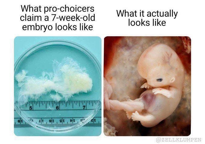 Revisionistahhhh tweet media