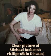 Ricardo Rickmansworth tweet media