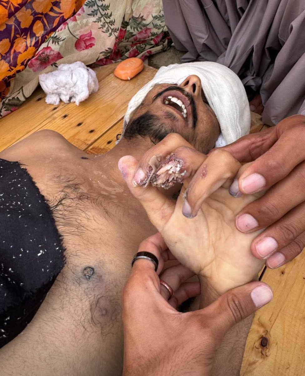 #Balochistan
In Panjgur, near Prom, different reports have surfaced regarding the body that was found, which had allegedly been missing a few days ago. According to today’s information, four other Baloch individuals were also killed in an alleged fake encounter along with him.