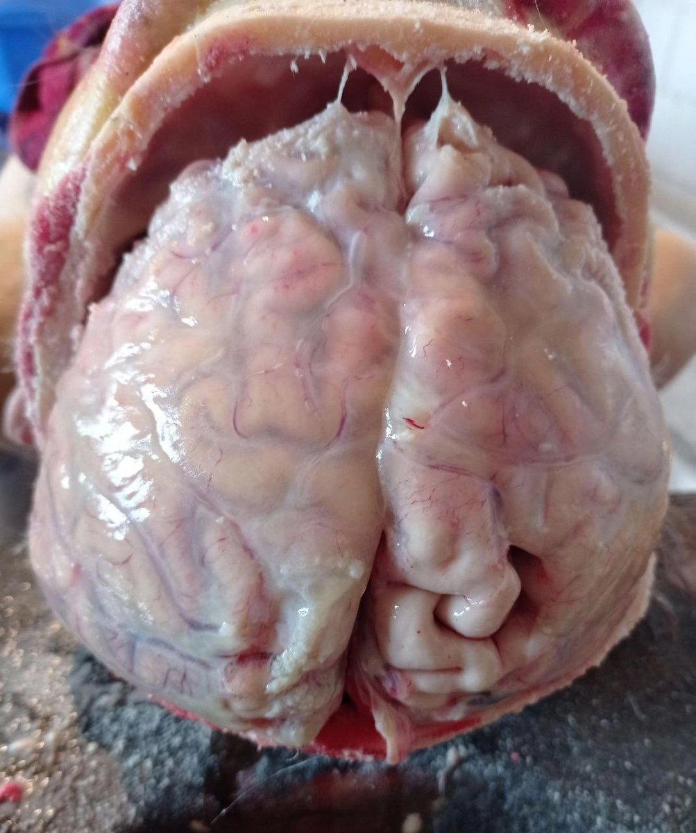 Dr Ihab Suliman tweet media