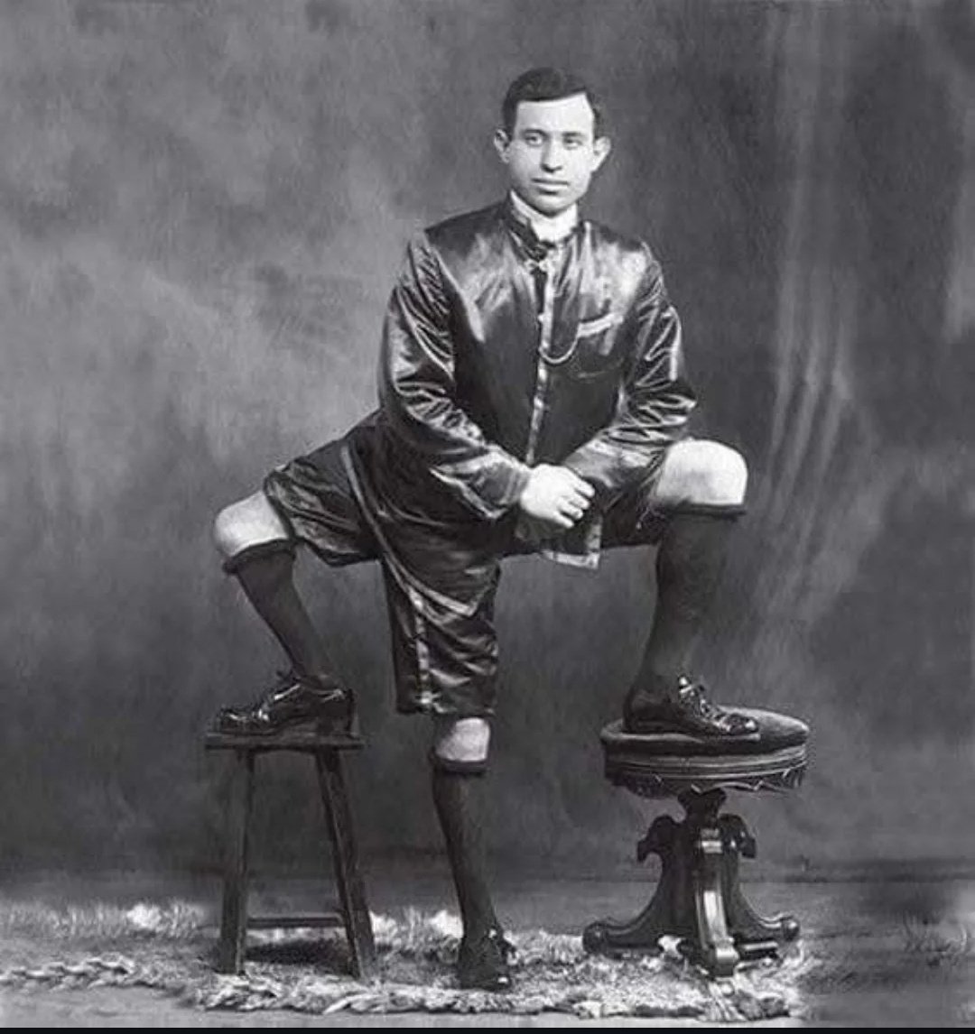This man was born with 3 legs, 4 feet, 16 toes and two functioning PENISES 😲.

He is Francesco "Frank" Lentini, an Italian-American showman who had two wives and 4 children. 

He lived until the age of 77.