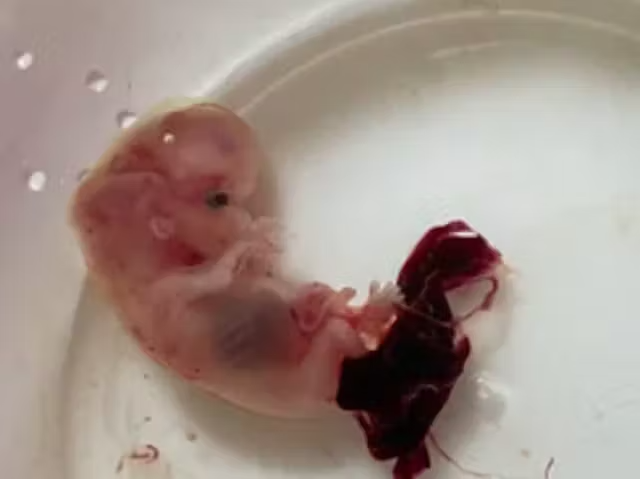 Live Action tweet media