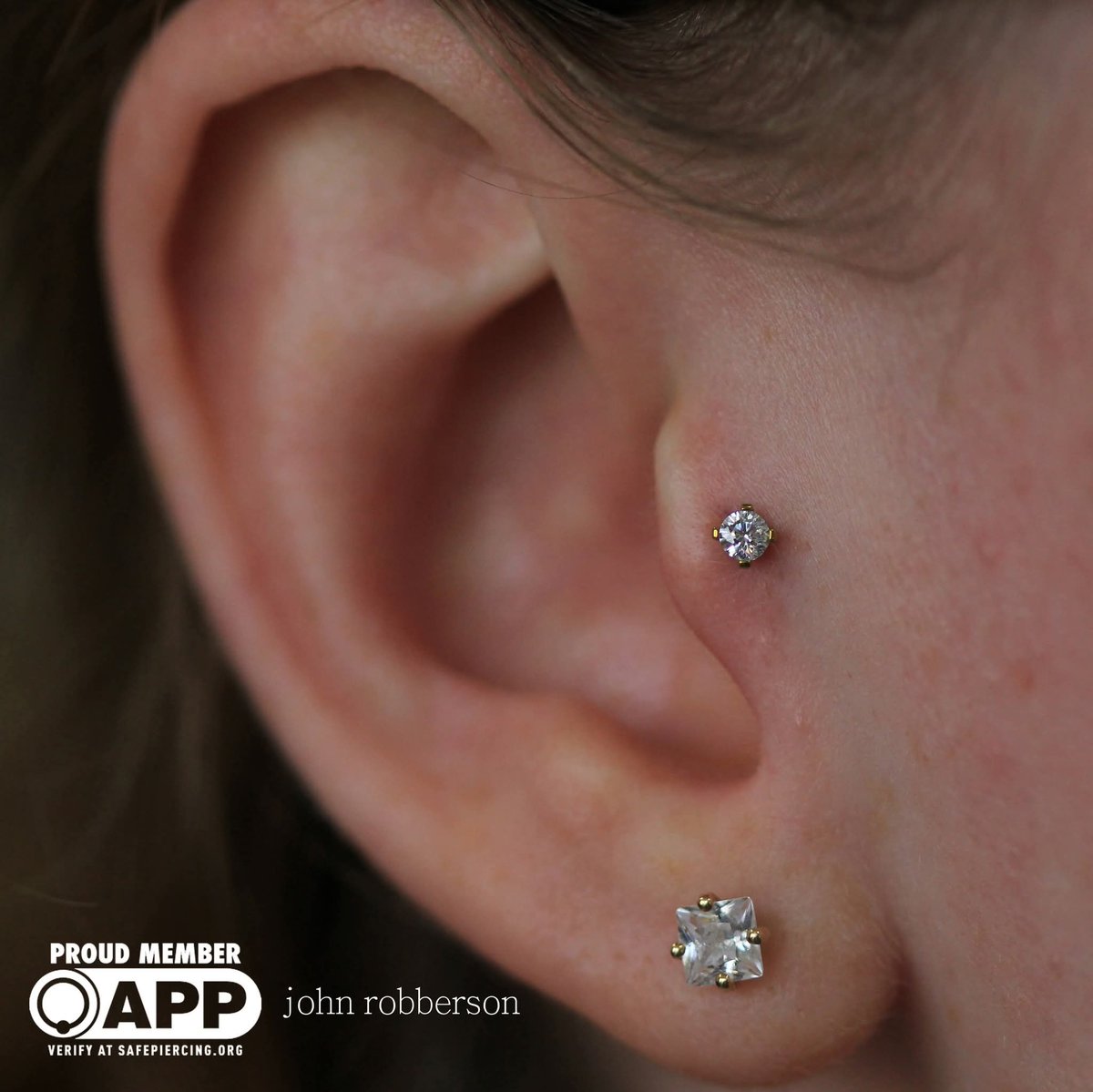 Tragus