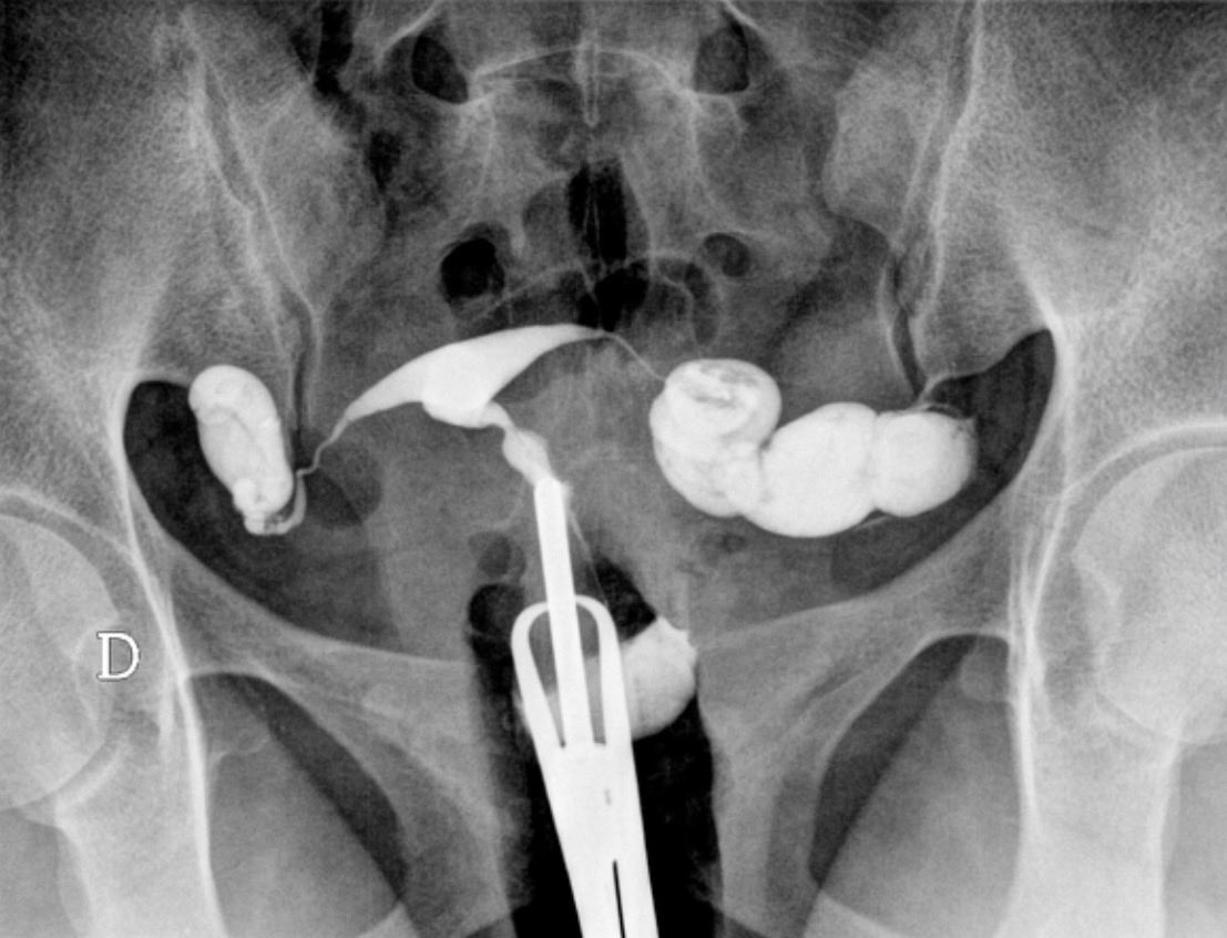 Carlos De Bonrostro 🏥 tweet media