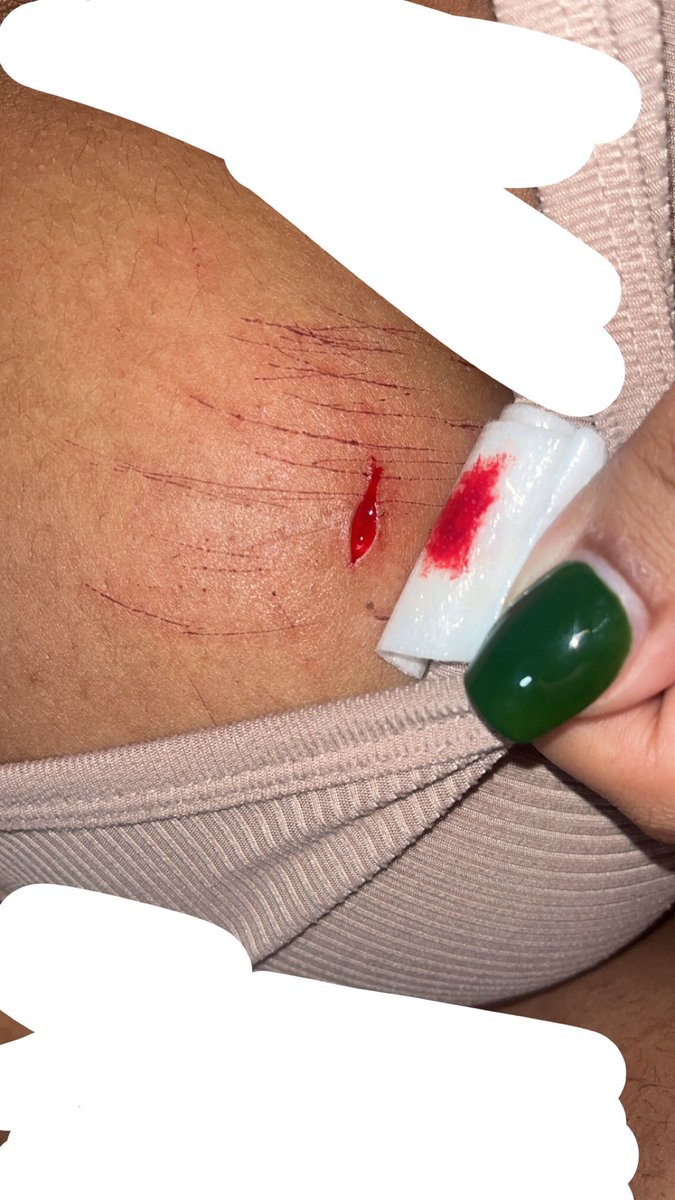 ࣪ ִֶָ🦇་༘꩜*𝔩𝔬𝔤𝔞𝔫*࣪ ִֶָ🦇་༘꩜ forced recovery tweet media