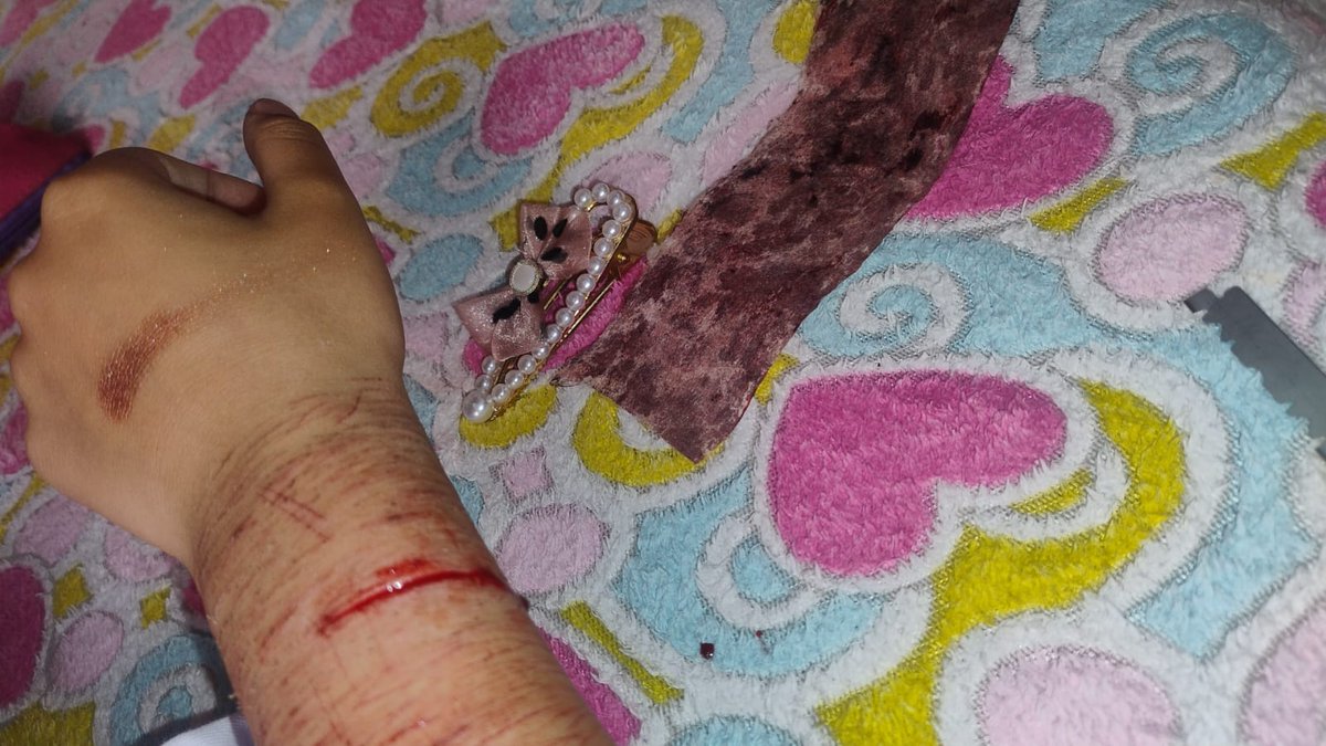 Ana571554526728's tweet image. moñito #shtwt #blood