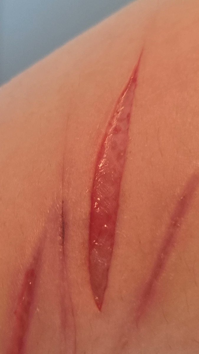 alice :3 tweet media