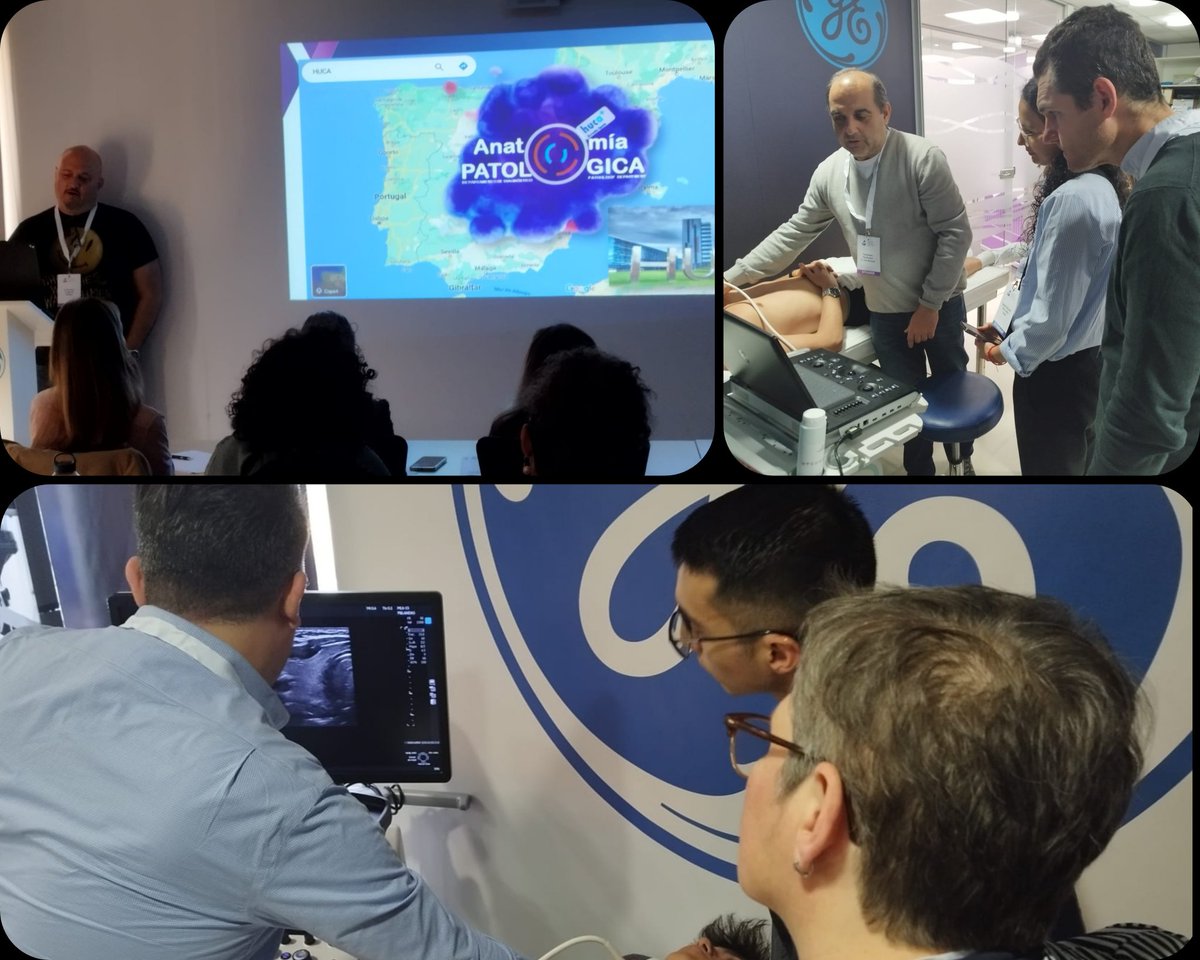 USFNA_SPAIN's tweet photo. 💉 Interventional Ultrasound for Pathologists course.
1️⃣ Day! https://t.co/zjSk7FOxMs