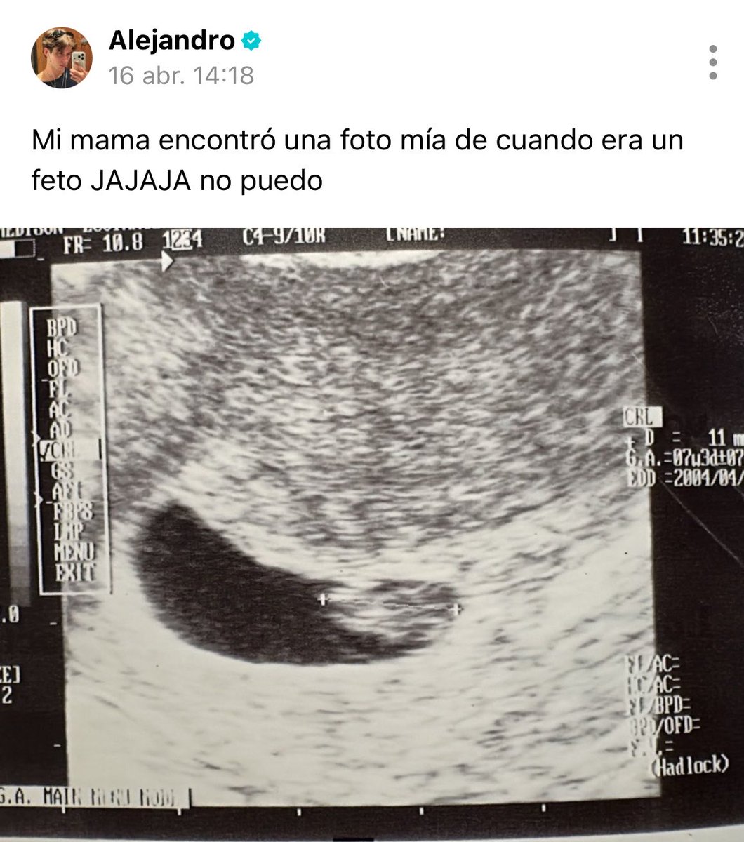 ale compartiéndonos su etapa de feto JAJAJAJAJAJAJANAJBAN basta lo amo