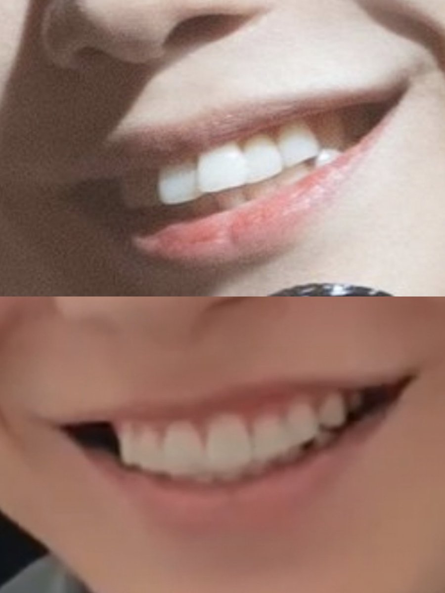 Ahhhh...Parece que os dentinhos de 🐇 já foram embora... 
Mas era necessário e para o bem dele, então 🆗...👏🏻😉

#KANGDANIEL
#KDBB