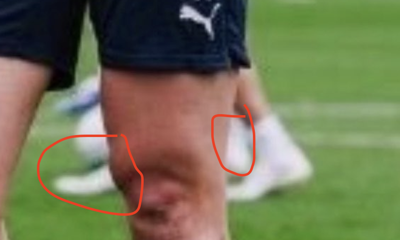 Too Much FPL 🦥 tweet media