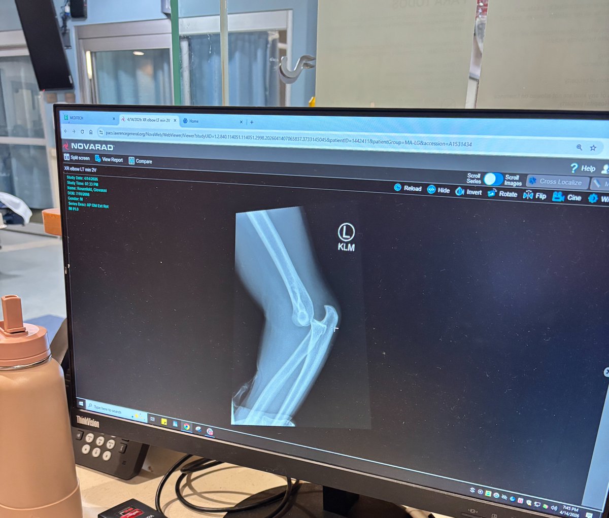 GioRosenfeld's tweet photo. Built for it. Back soon. #dislocation https://t.co/ow5aitoeMb