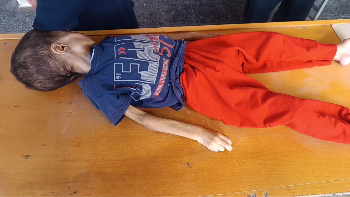 كيف سنروي احداث العدوان على غزة للأجيال القادمة من ابناءئنا وأحفادنا، يمكن أن نتخيل ذلك بعد عشرات السنين على النحو التالي:

هكذا سنحكي لأحفادنا قصة #غزة👇

كانت الحرب على غزة والإبادة التي تعرض لها الشعب الفلسطيني  من أعظم الكوارث الإنسانية في العصر الحديث، لما لها من وقع عظيم