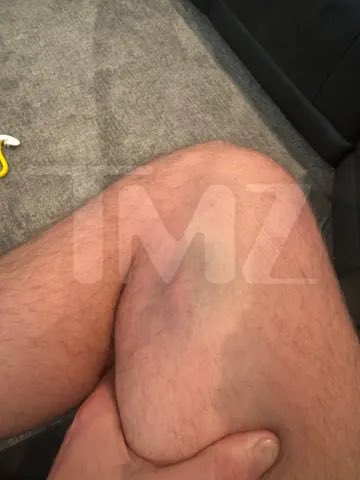 Bye Wig Hello Drama tweet media