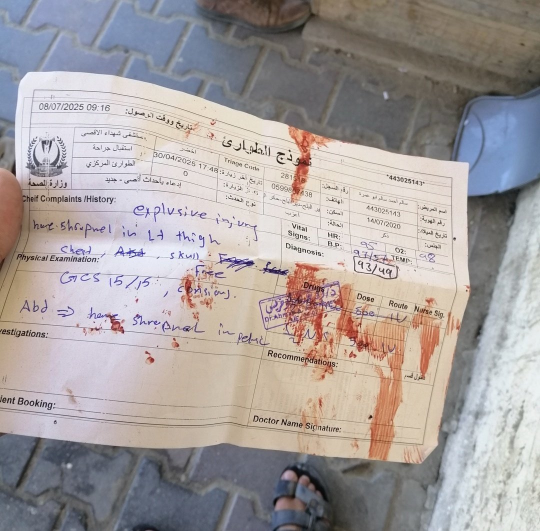 كنت ادور بيض من فترة طويلة لابن عمي بعاني من عظمه بعد الاصابة، ف قبل يومين ماشي لقيت بالمعسكر نقطة بيع بيض والناس واقفين دور، نصف طبق للشخص ، وقفت ساعة بلا فايدة، رحت للمحل حكتلهم بدي البيض لمصاب وحالته صعبة قالي هات تقرير عشان اعطيك، حكتله هي ورقة دخول المستشفى لسا بدمها للطفل+