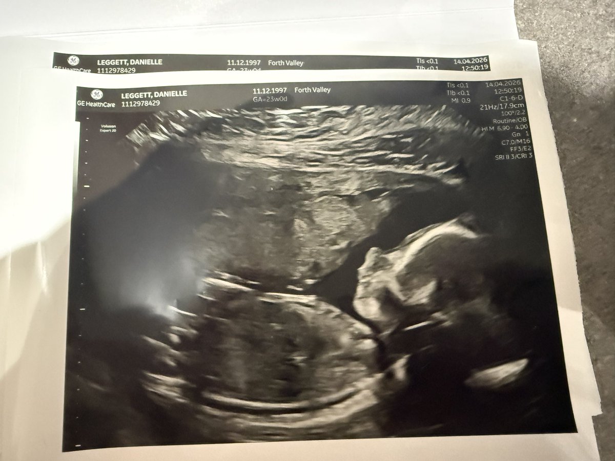 My little baby 🥺💗