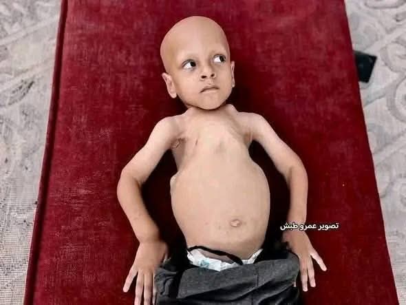 bouchraSahrane's tweet photo. كي لا ننسى أطفال غزة جاعوا في بلاد بها 22 جيش عربي حقير وضبع و22 حاكم عربي قبل مؤخرة ترامب..كلهم خونة لا يخدعكم احد بالشعارات الكادبة عامين حرب كشفتكم يامنافقين... https://t.co/v0BFWvUuvw
