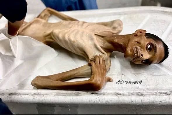 bouchraSahrane's tweet photo. كي لا ننسى أطفال غزة جاعوا في بلاد بها 22 جيش عربي حقير وضبع و22 حاكم عربي قبل مؤخرة ترامب..كلهم خونة لا يخدعكم احد بالشعارات الكادبة عامين حرب كشفتكم يامنافقين... https://t.co/v0BFWvUuvw