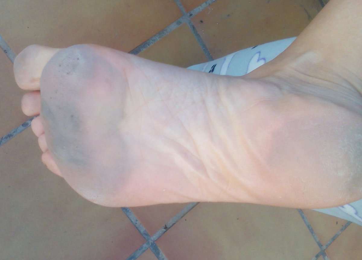 Reina del Dolor&Placer tweet media