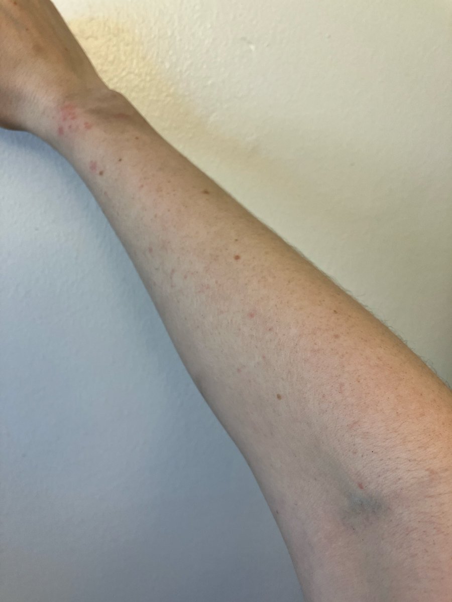 Pepper Chips tweet media