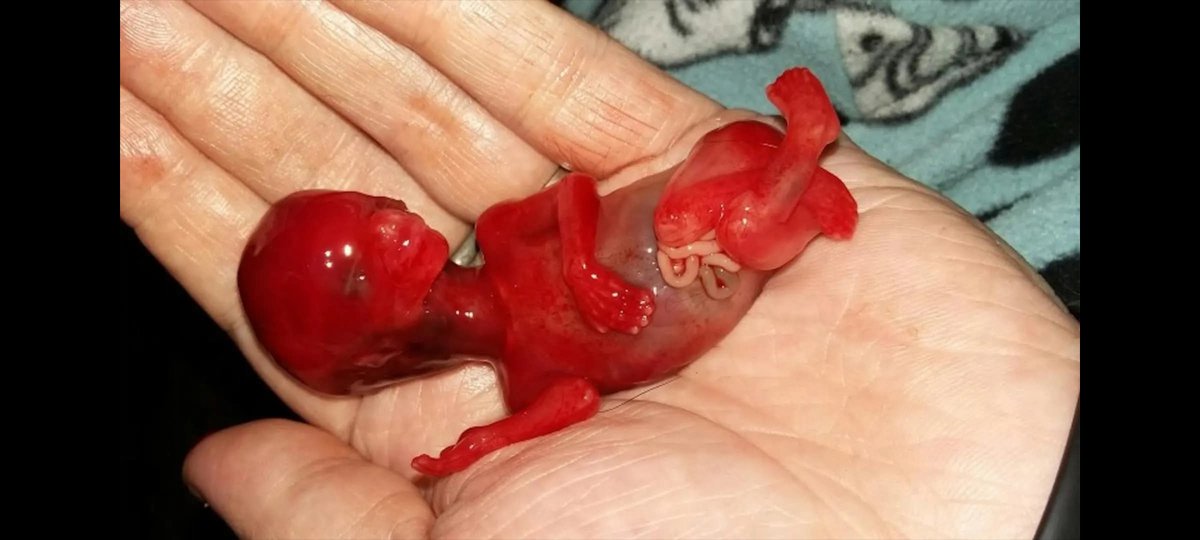 Don Mateyo tweet media