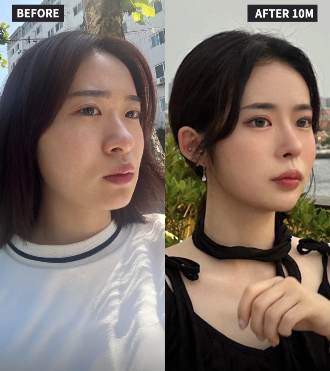 JT整形外科(輪郭・鼻・目専門) tweet media