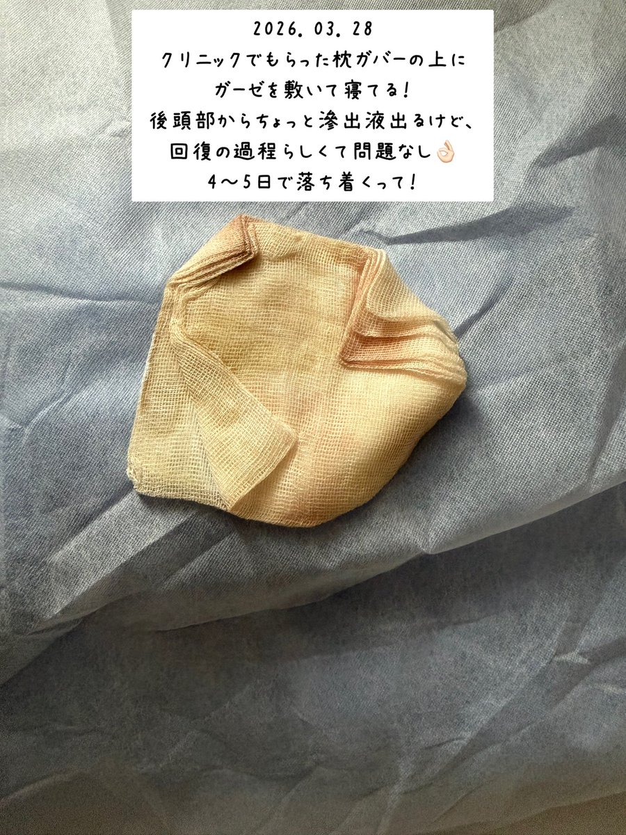 0c__73's tweet photo. 術後1週間くらい経過した写真 後頭部やっと落ちついてきた😮‍💨 https://t.co/WsEdnCIWPA