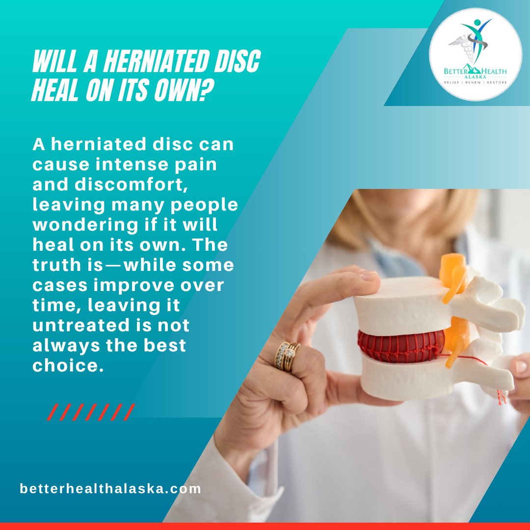BetterHealthAK's tweet image. Will a herniated disc heal on its own? 🤔
Sometimes—but not always.
Ignoring it can lead to prolonged pain and complications.
The right care makes all the difference 💙
#BetterHealthAlaska #HerniatedDisc #BackPainRelief #ChiropracticCare