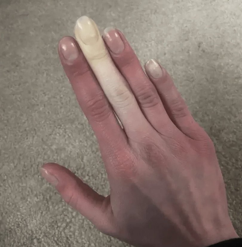 Liberta Cherguia 🇪🇺 tweet media