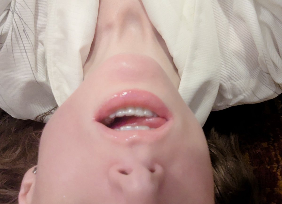 Аннушка 🩹 tweet media