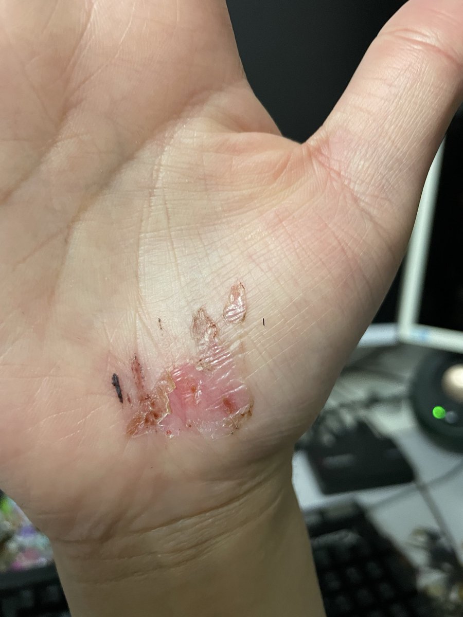 クリサリス tweet media