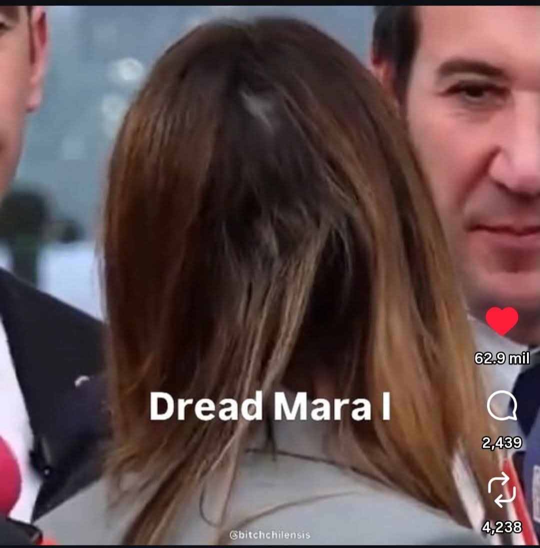 O le pegaron un Chicle o no se lavo bien el pelo 😆
Con razón la Argandoña la pela pues 😁
