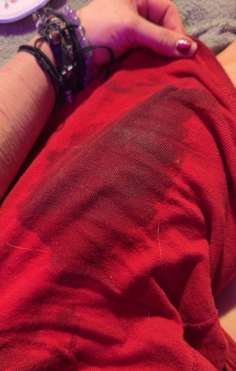 scarlette / shedtwt tweet media