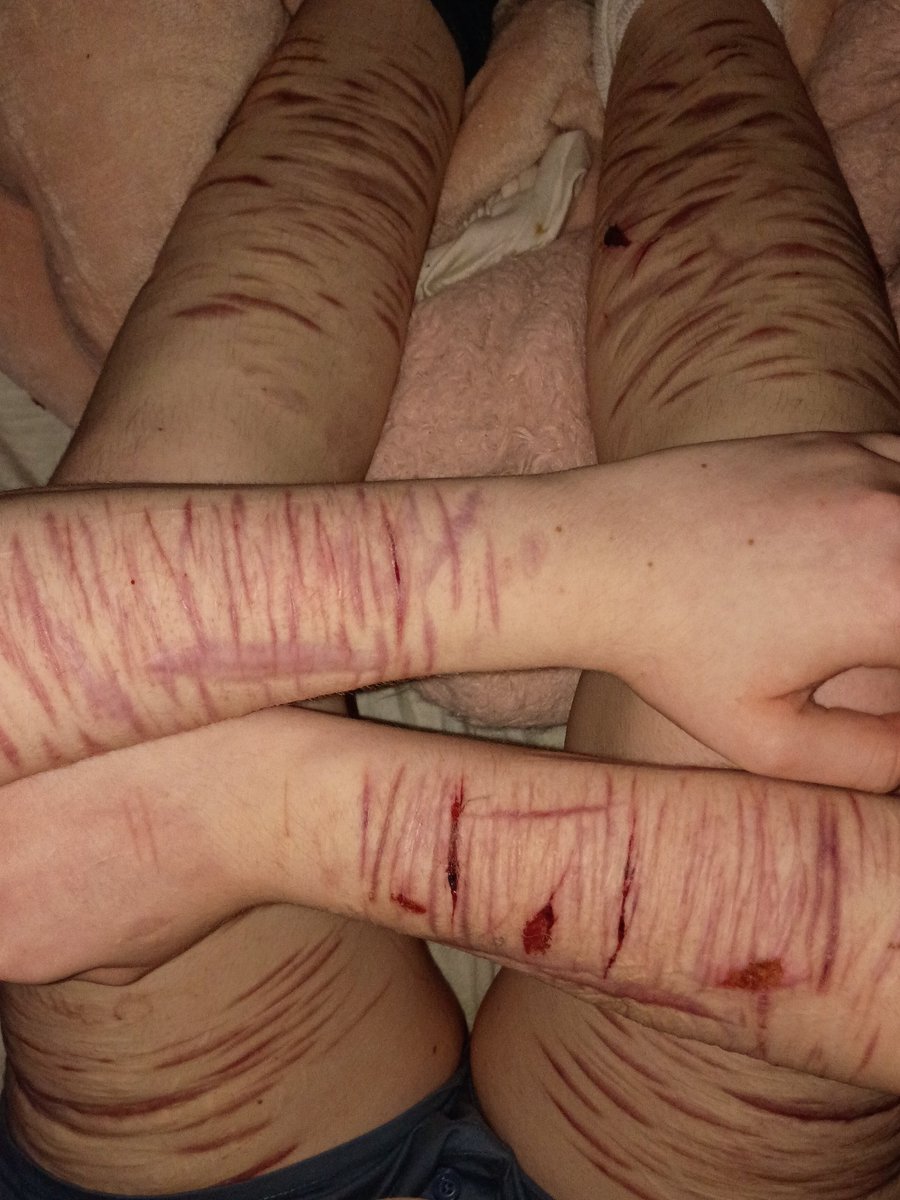 emily of shedtwt tweet media