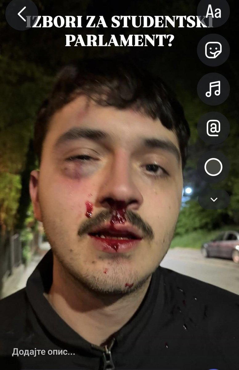 Ova krvava glava budućeg lekara, pretučena od strane tzv policije je dovoljan poziv da svi što pre krenu da brane fakultet. Medicinski fakultet je svetinja, naši životi će biti u rukama te dece, a ne ćacadi! Hitno je ljudii‼️‼️‼️‼️