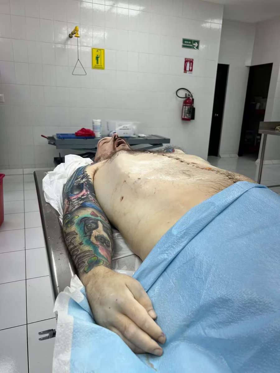 ANTI FOCAS SV tweet media