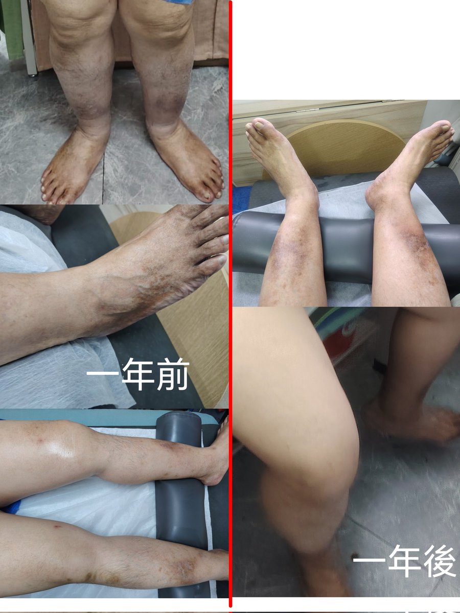 泓悅。保健養生 tweet media