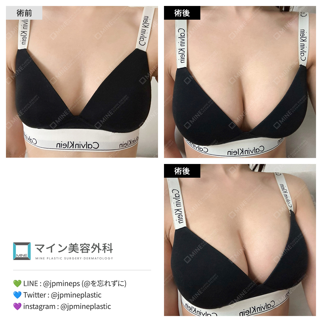 マイン美容外科・皮膚科 tweet media