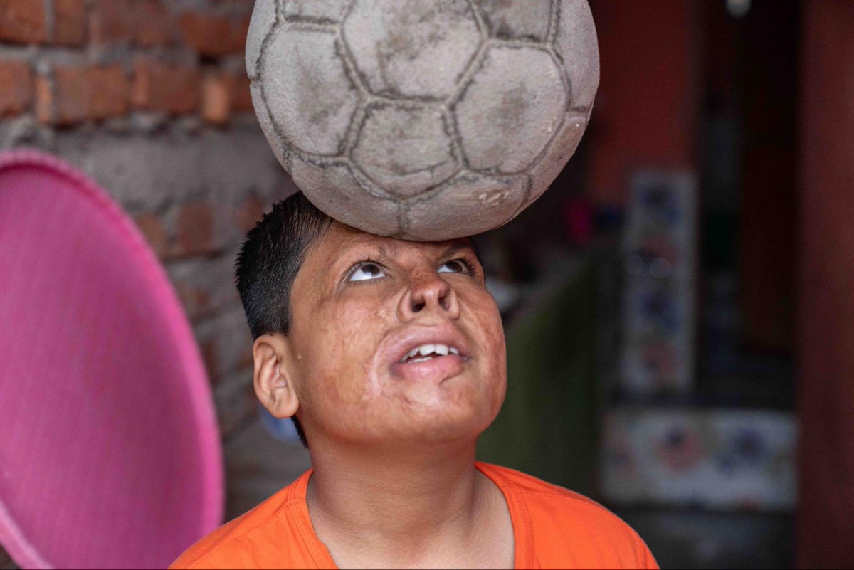 ReSurge's tweet photo. We love to kick it ⚽ with Ayush, who's back on the soccer field and always close to our hearts. https://t.co/naUN8mhon5