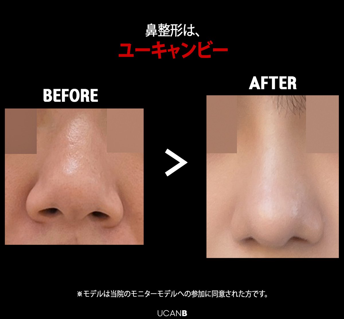 【公式】UcanB美容外科・皮膚科 tweet media