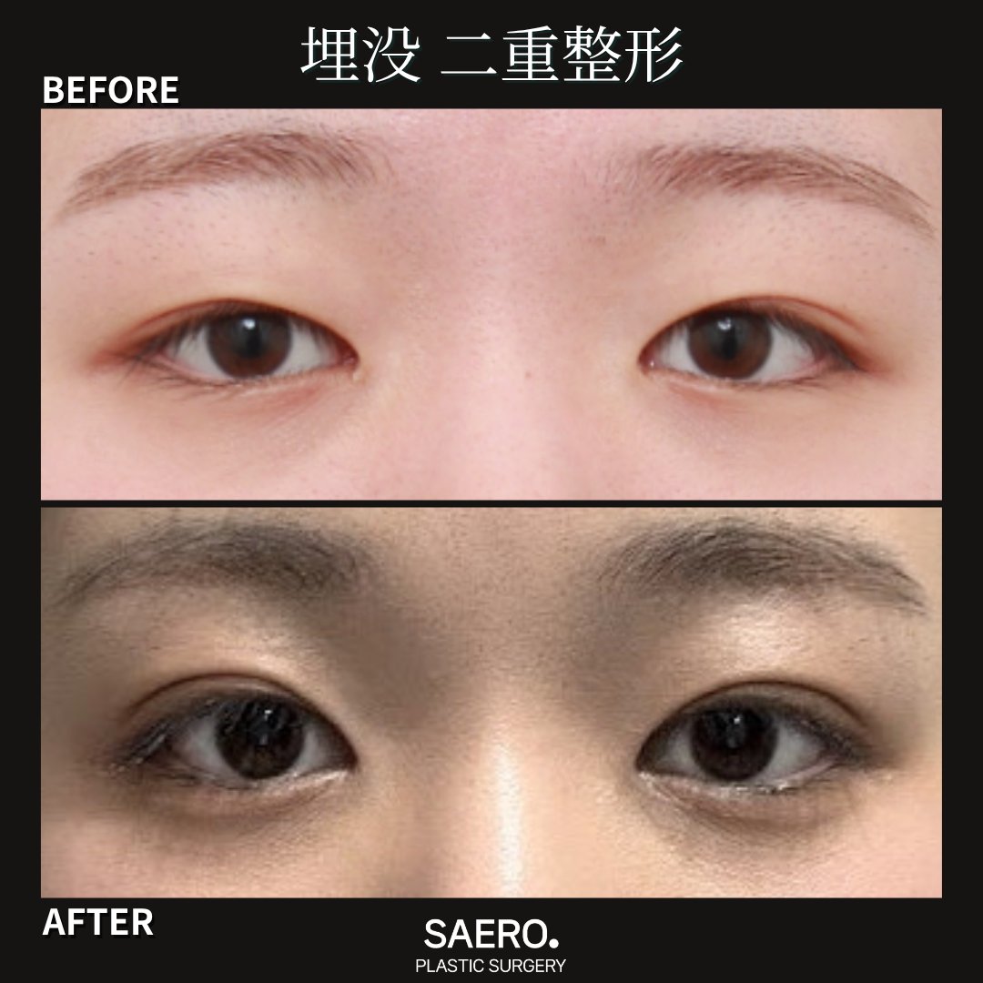 セロ美容外科 tweet media