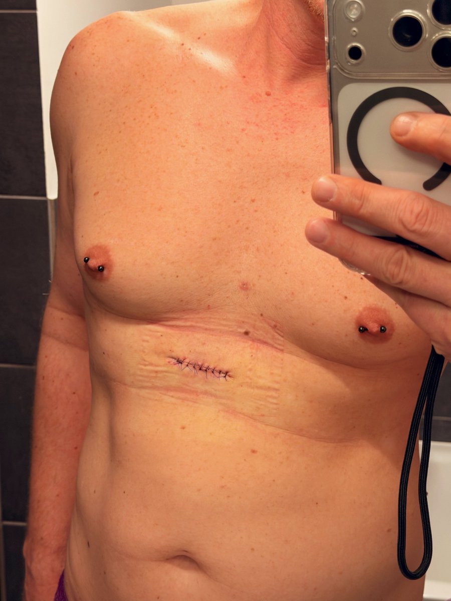 Chris  𝕏 tweet media