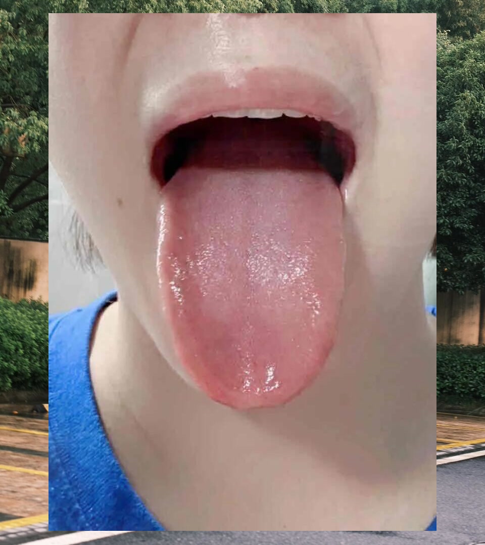 Brandon Lambert tweet media